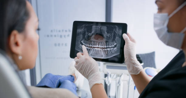 Licensed Teeth Cleaning And Checkup service in Carol Stream, IL - Smile Center Dentistry